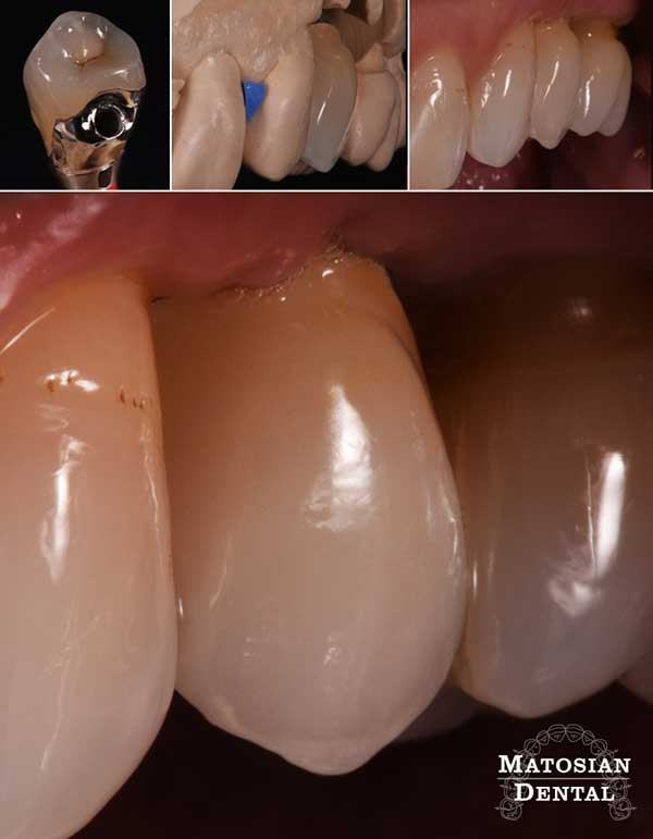 dental images 91942